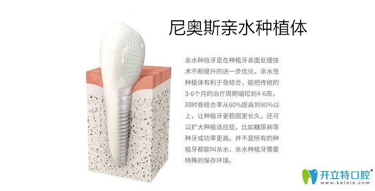 尼奧斯親水種植體介紹