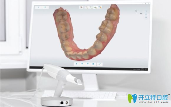 合肥壹加壹口腔引進有美國銳珂口掃儀