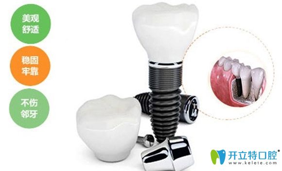 一顆種植牙價格包含有種植體和基臺以及牙冠