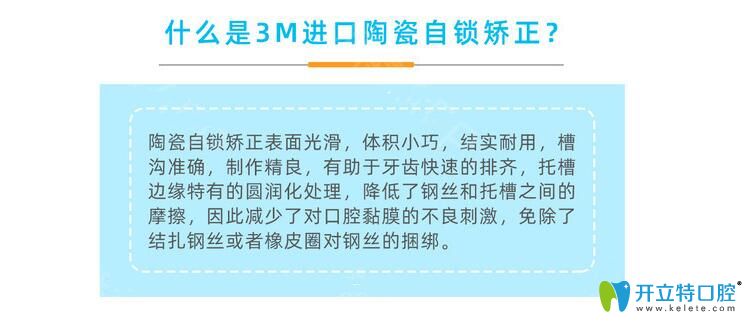 3m陶瓷自鎖托槽簡(jiǎn)介