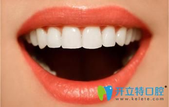 做烤瓷牙后牙齒矯正圖片