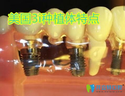 美國(guó)3i種植牙特點(diǎn)