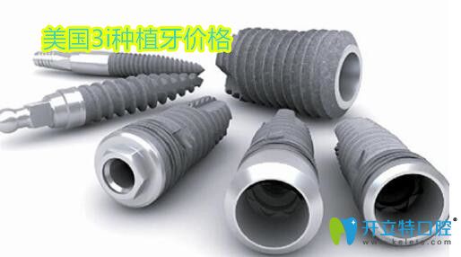 美國(guó)3i種植體費(fèi)用