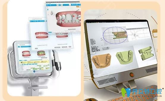 3D口掃儀