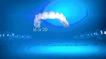 隱適美IGO隱形矯正速度快且安全