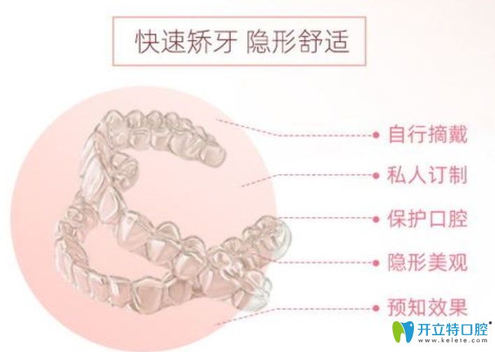 時代天使隱形矯正價格 時代天使隱形矯正價格