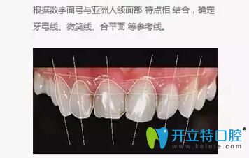 西安中諾口腔任康介紹什么是DSD數(shù)碼微笑美學修復(fù)設(shè)計