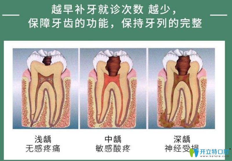 哪些牙齒情況可以補(bǔ)牙