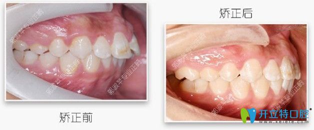 對比下矯正前后的照片，效果還是不錯吧
