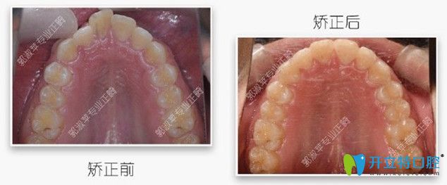 矯正時，選對醫(yī)生很重要