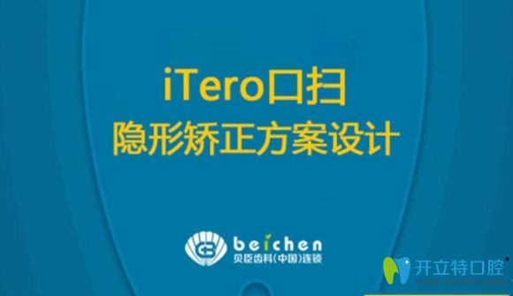 風(fēng)靡福州正畸界的隱適美iTero口掃僅需9.9元就可體驗(yàn)哦!