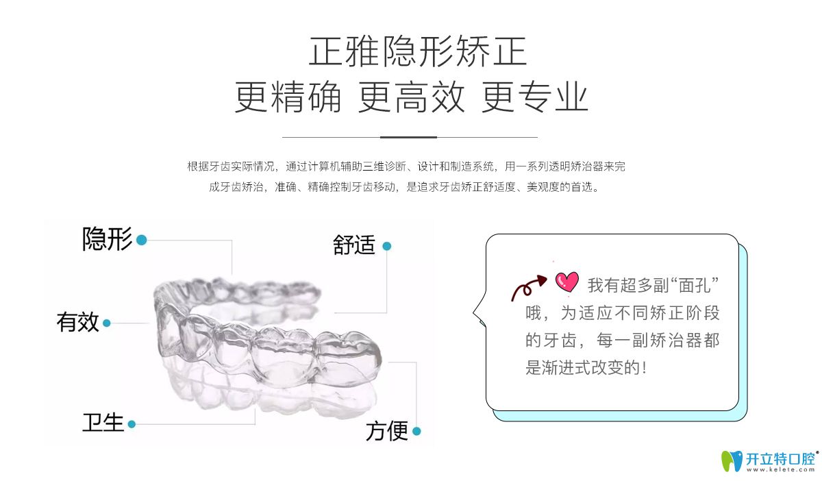 正雅隱形矯正優(yōu)勢介紹