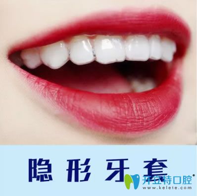 重慶維樂口腔隱形牙套