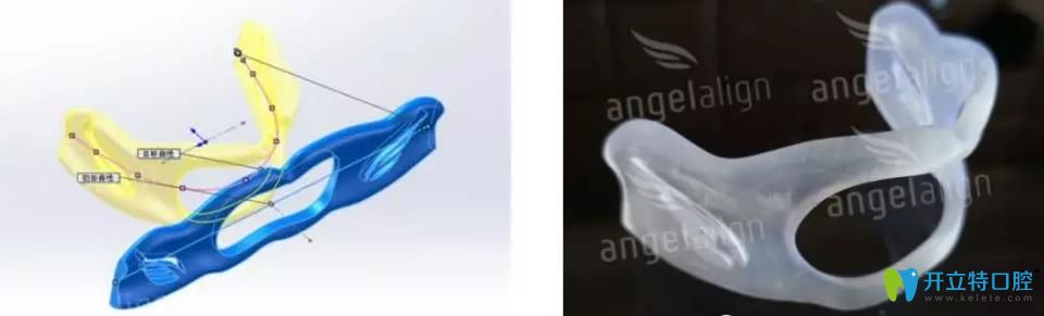 時代天使kid矯正器外觀