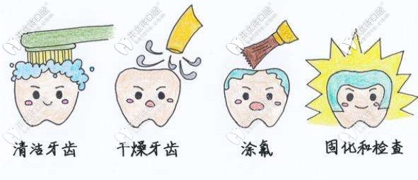 圣貝口腔兒童涂氟