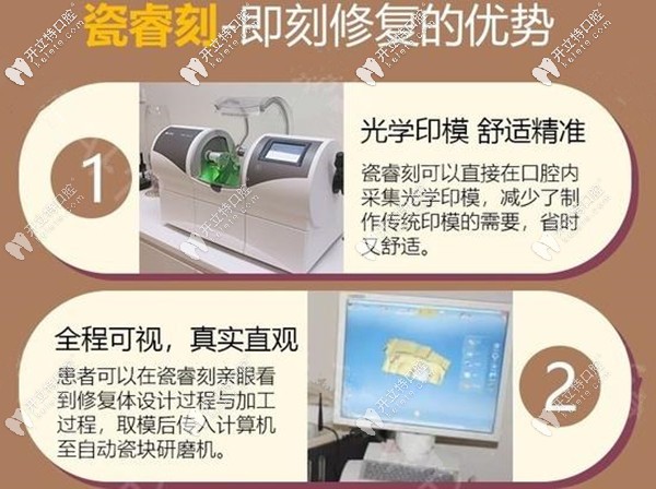 瓷?？碳纯绦迯?fù)的優(yōu)勢(shì)