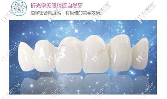 瓷睿刻全瓷牙接近真牙效果