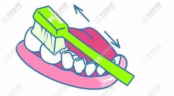 每?jī)深w到三顆牙前后來回刷