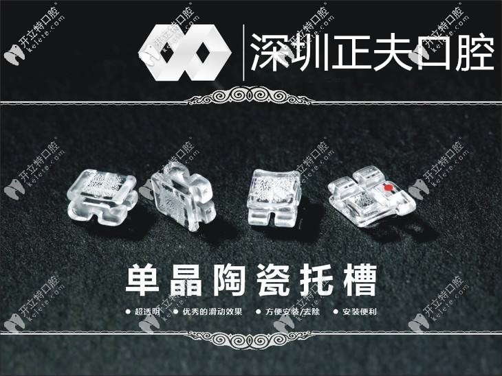 單晶托槽矯正價格