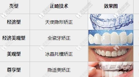 牙齒矯正的不同方式