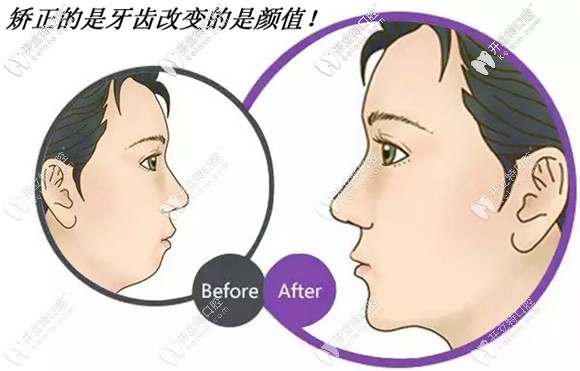 數(shù)字化矯正還兼顧了顏面美學(xué)設(shè)計