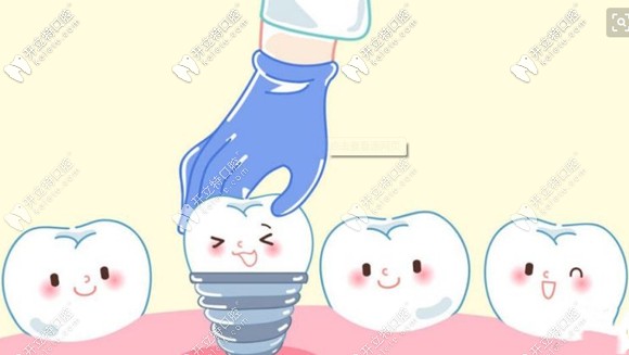 如何選擇靠譜的私立醫(yī)院做種植牙呢