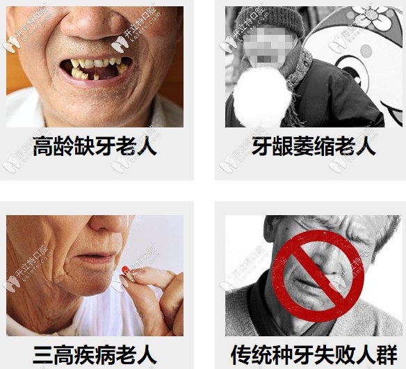 高齡缺牙、牙槽骨萎縮等都可以做種植牙