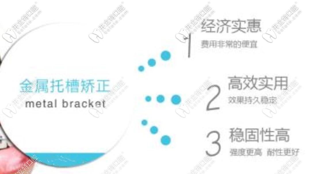 金屬矯正的優(yōu)勢