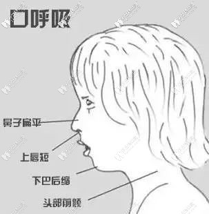 兒童的不良習(xí)慣會導(dǎo)致長得不好看