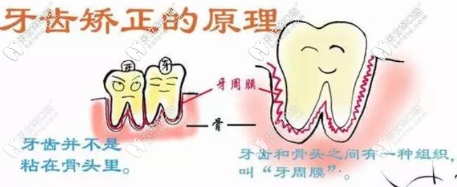 牙齒矯正的原理 牙齒矯正的原理