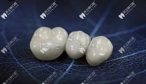 吉爾巴赫氧化鋯全瓷牙