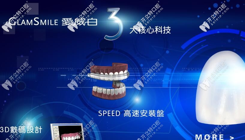 別問(wèn)多少錢了，先來(lái)科普下愛(ài)威白牙齒貼面的秘密