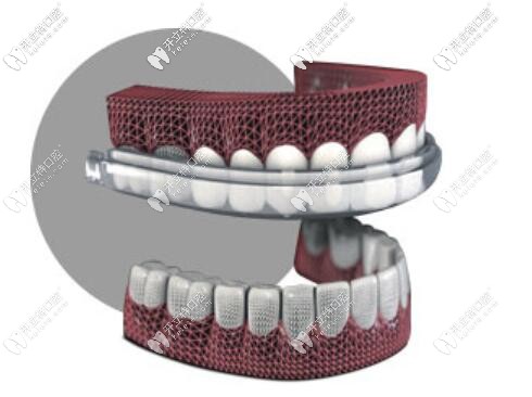 愛威白SPEED 1小時安裝盤