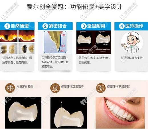 愛(ài)爾創(chuàng)瓷倍健全瓷牙優(yōu)勢(shì)