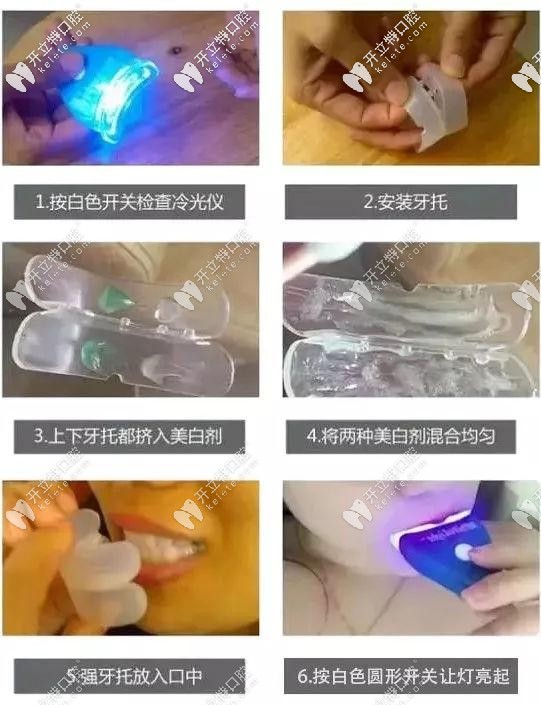 很多美牙儀都是三無產(chǎn)品