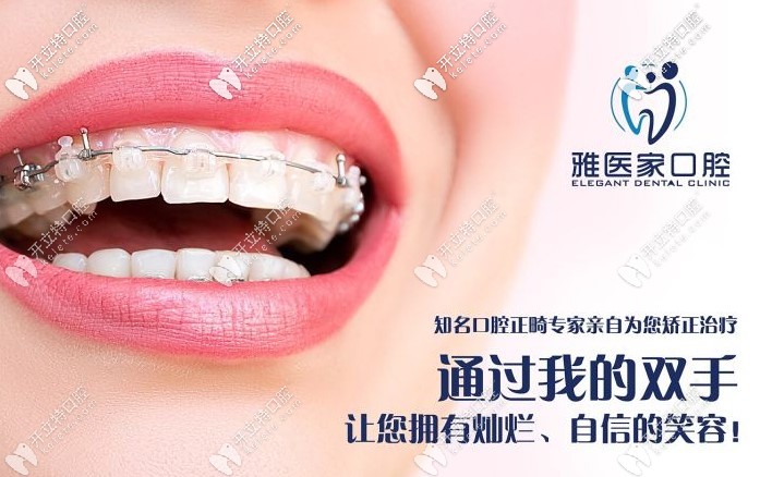 雅醫(yī)家口腔的特色項目