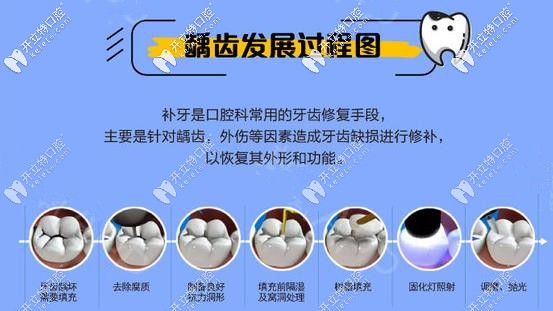 補(bǔ)牙的過(guò)程