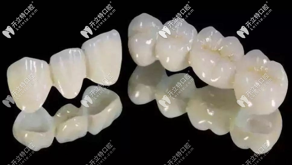 柏樂口腔全瓷牙冠