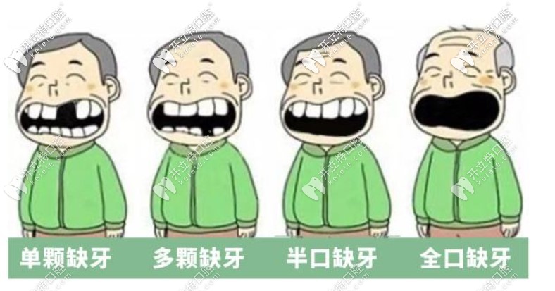 種植牙價格表