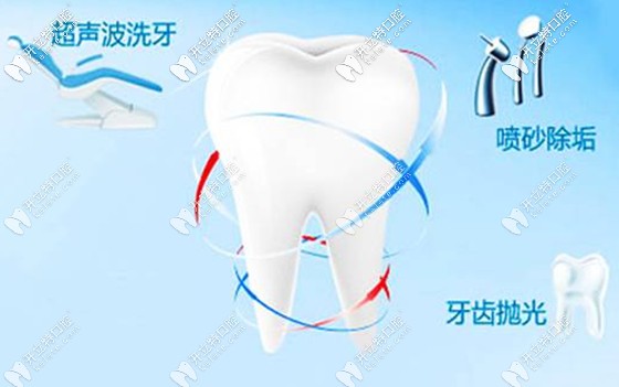 洗牙加噴砂拋光是口腔保健的基本