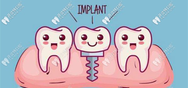 骨增量種植技術(shù)的講解 骨增量種植技術(shù)的講解