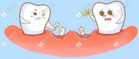 骨量少可以通過(guò)上頜竇提升技術(shù)改善 骨量少可以通過(guò)上頜竇提升技術(shù)改善