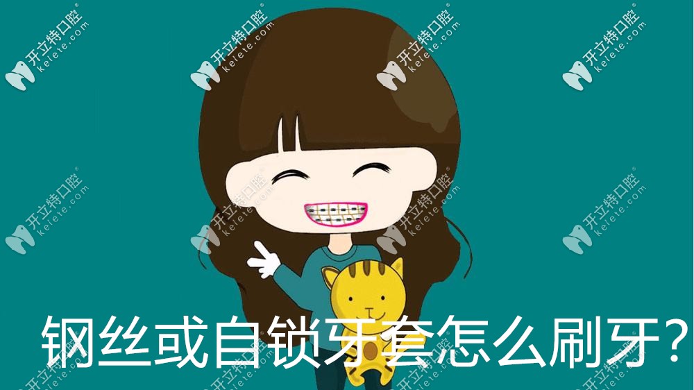 真捉急，剛戴牙套怎么刷牙啊