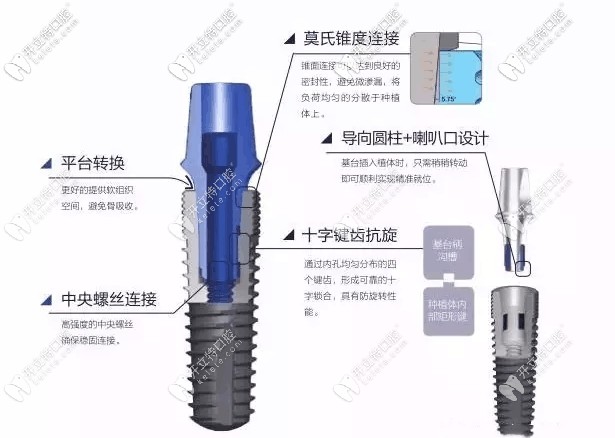 國(guó)產(chǎn)威高種植體介紹