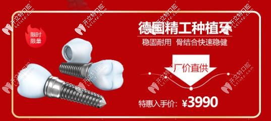 西安諾貝爾齒科德國種植牙活動價格