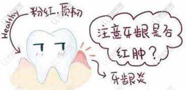 矯正時(shí)要注意牙齦是否紅腫
