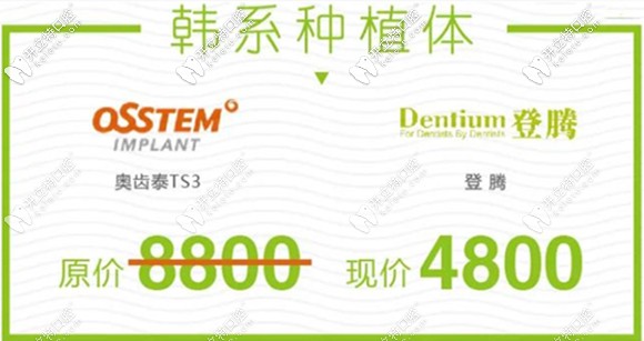 原價8800元的韓國奧齒泰和登騰種植體現(xiàn)特價4800元