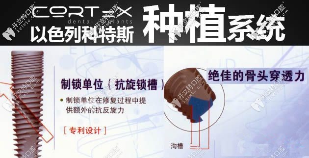 以色列cortex種植體優(yōu)點