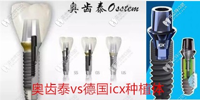 品質(zhì)vs價(jià)格,看看德國(guó)ICX和韓國(guó)奧齒泰種植體到底選擇哪個(gè)好
