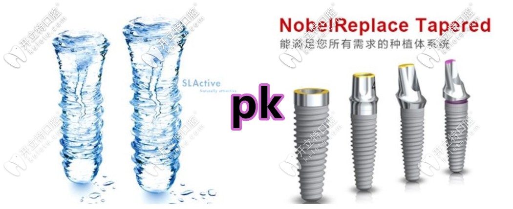 都是上萬(wàn)的種植牙,諾貝爾active和iti鈦鋯親水種植體哪個(gè)更好